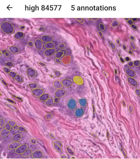 Pathology Annotation App for The Netherlands Cancer Institute